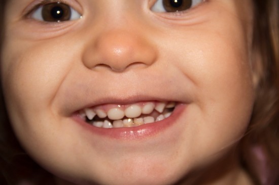 Как сохранить здоровье детских зубов (2)