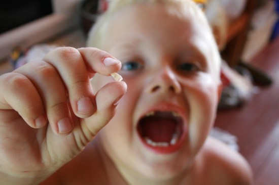 Стоит ли лечить молочные зубы у детей2